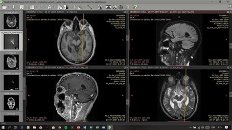 RadiAnt DICOM Viewer 2025 Full Crack + Serial Key